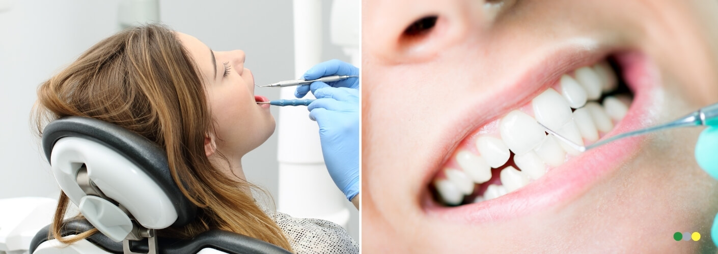 limpieza dental para prevenir la gingivitis
